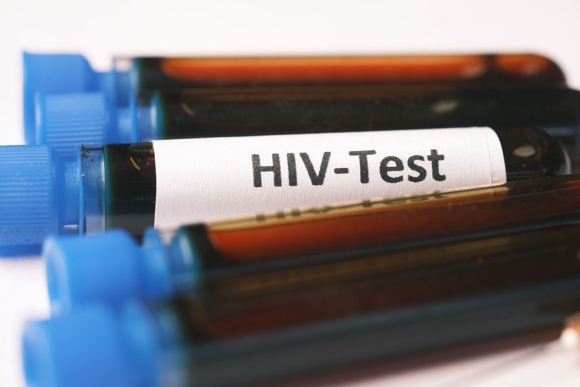 HIV test tubes in a lab